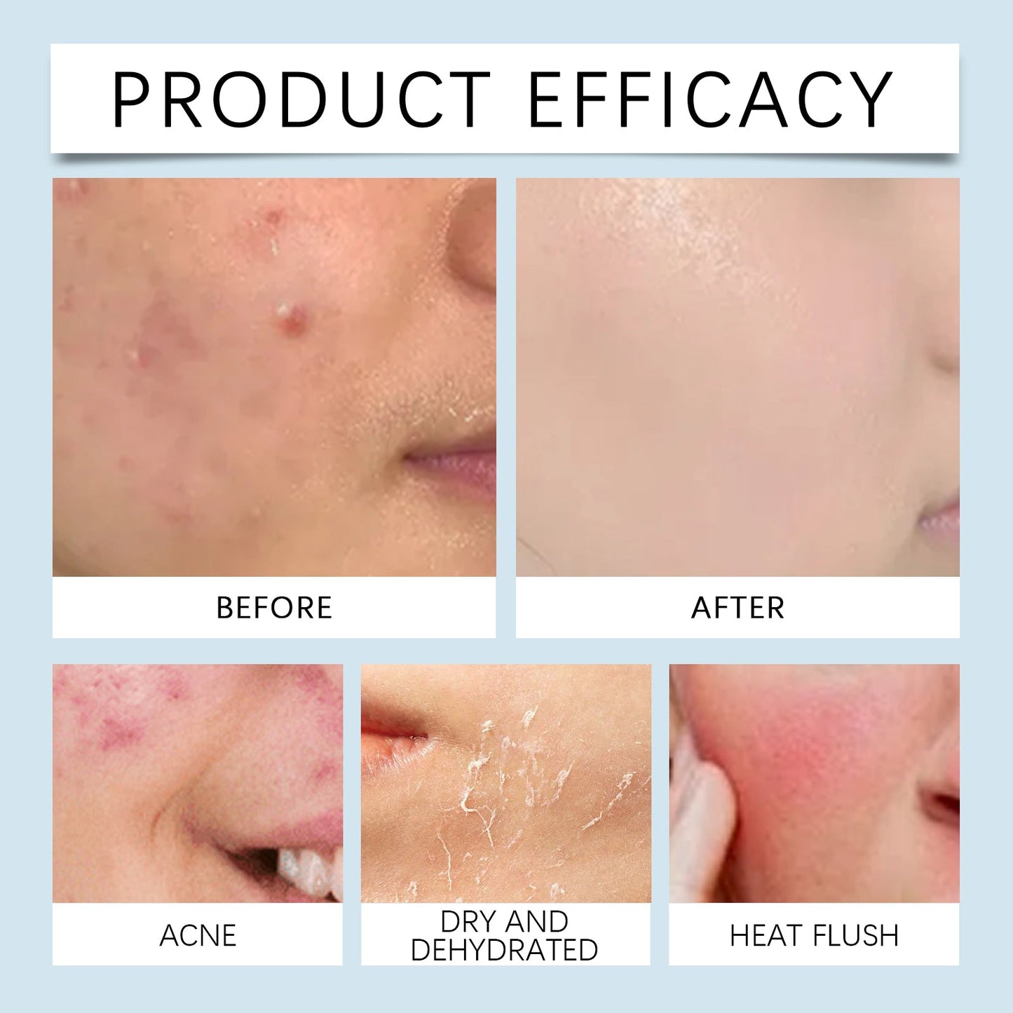 Hyaluronic Acid Hydrating Face Serum